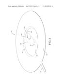 RUPTURE DISC HAVING LASER-DEFINED REVERSAL INITIATION AND DEFORMATION     CONTROL FEATURES diagram and image