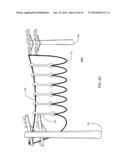 ADJUSTABLE SUSPENSION OF TRANSMISSION LINES diagram and image