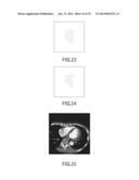 RENDERING PROCESSING METHOD AND APPARATUS diagram and image