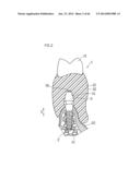 DENTURE SYSTEM, ENGAGEMENT PIECE USED FOR DENTURE SYSTEM, METHOD FOR     PRODUCING DENTURE BASE AND DENTURE diagram and image