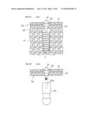 DENTURE SYSTEM, ENGAGEMENT PIECE USED FOR DENTURE SYSTEM, METHOD FOR     PRODUCING DENTURE BASE AND DENTURE diagram and image