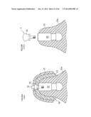 DENTURE SYSTEM, ENGAGEMENT PIECE USED FOR DENTURE SYSTEM, METHOD FOR     PRODUCING DENTURE BASE AND DENTURE diagram and image