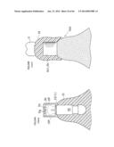 DENTURE SYSTEM, ENGAGEMENT PIECE USED FOR DENTURE SYSTEM, METHOD FOR     PRODUCING DENTURE BASE AND DENTURE diagram and image