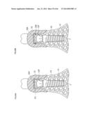 DENTURE SYSTEM, ENGAGEMENT PIECE USED FOR DENTURE SYSTEM, METHOD FOR     PRODUCING DENTURE BASE AND DENTURE diagram and image