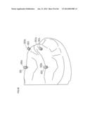 DENTURE SYSTEM, ENGAGEMENT PIECE USED FOR DENTURE SYSTEM, METHOD FOR     PRODUCING DENTURE BASE AND DENTURE diagram and image