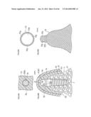 DENTURE SYSTEM, ENGAGEMENT PIECE USED FOR DENTURE SYSTEM, METHOD FOR     PRODUCING DENTURE BASE AND DENTURE diagram and image