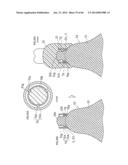 DENTURE SYSTEM, ENGAGEMENT PIECE USED FOR DENTURE SYSTEM, METHOD FOR     PRODUCING DENTURE BASE AND DENTURE diagram and image