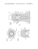 DENTURE SYSTEM, ENGAGEMENT PIECE USED FOR DENTURE SYSTEM, METHOD FOR     PRODUCING DENTURE BASE AND DENTURE diagram and image