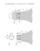 DENTURE SYSTEM, ENGAGEMENT PIECE USED FOR DENTURE SYSTEM, METHOD FOR     PRODUCING DENTURE BASE AND DENTURE diagram and image