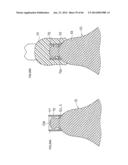 DENTURE SYSTEM, ENGAGEMENT PIECE USED FOR DENTURE SYSTEM, METHOD FOR     PRODUCING DENTURE BASE AND DENTURE diagram and image