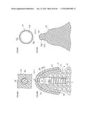 DENTURE SYSTEM, ENGAGEMENT PIECE USED FOR DENTURE SYSTEM, METHOD FOR     PRODUCING DENTURE BASE AND DENTURE diagram and image