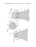 DENTURE SYSTEM, ENGAGEMENT PIECE USED FOR DENTURE SYSTEM, METHOD FOR     PRODUCING DENTURE BASE AND DENTURE diagram and image