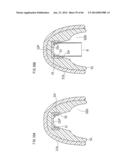 DENTURE SYSTEM, ENGAGEMENT PIECE USED FOR DENTURE SYSTEM, METHOD FOR     PRODUCING DENTURE BASE AND DENTURE diagram and image