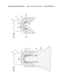 DENTURE SYSTEM, ENGAGEMENT PIECE USED FOR DENTURE SYSTEM, METHOD FOR     PRODUCING DENTURE BASE AND DENTURE diagram and image