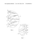 SELF-OSTEOTOMIZING BONE IMPLANT AND RELATED METHOD diagram and image