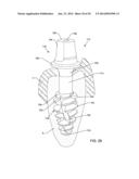 SELF-OSTEOTOMIZING BONE IMPLANT AND RELATED METHOD diagram and image