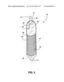 Dental Implant and Method of Use with Improved Maxillary Stability diagram and image