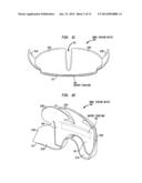 BOWEL PACKING DEVICE HAVING A SUPPORT STRUCTURE diagram and image