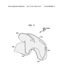 BOWEL PACKING DEVICE HAVING A SUPPORT STRUCTURE diagram and image