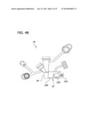 Feeding Tube System with Imaging Assembly and Console diagram and image