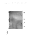 Feeding Tube System with Imaging Assembly and Console diagram and image