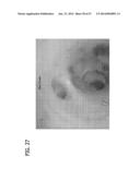 Feeding Tube System with Imaging Assembly and Console diagram and image