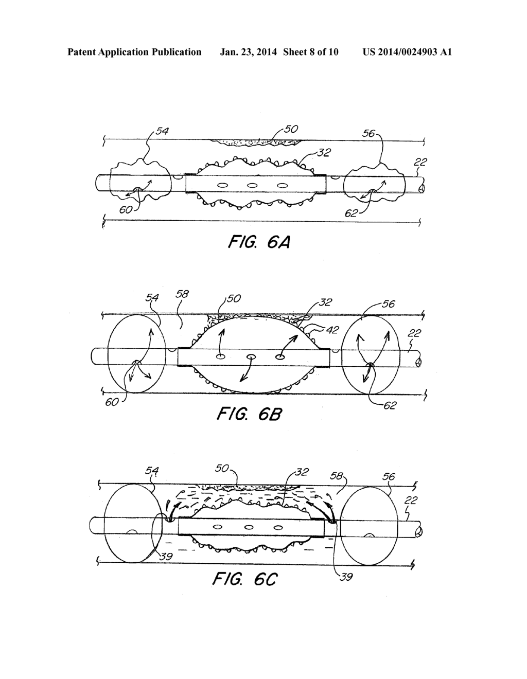 Abrading Balloon Catheter for Extravasated Drug Delivery - diagram, schematic, and image 09