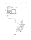 CATHETER WITH STRAIN GAUGE SENSOR diagram and image