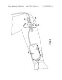 APPARATUS TO SECURE AND ADJUST FLEXIBLE CONDUIT diagram and image