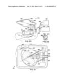 WOUND TREATMENT APPARATUS diagram and image