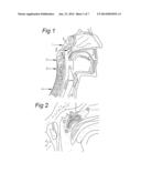 RESUSCITATION DEVICE AND METHOD FOR RESUSCITATION diagram and image