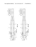 Solid-Body Catheter Including Lateral Distal Openings diagram and image