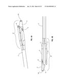 Solid-Body Catheter Including Lateral Distal Openings diagram and image