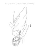 Solid-Body Catheter Including Lateral Distal Openings diagram and image