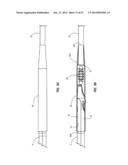 Solid-Body Catheter Including Lateral Distal Openings diagram and image