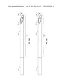 Solid-Body Catheter Including Lateral Distal Openings diagram and image