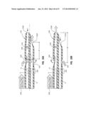 Solid-Body Catheter Including Lateral Distal Openings diagram and image