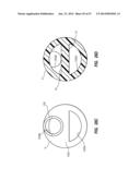 Solid-Body Catheter Including Lateral Distal Openings diagram and image