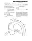 GUIDE EXTENSION CATHETER diagram and image