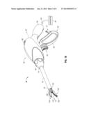 OPTICAL SEALING DEVICE WITH CUTTING ABILITY diagram and image