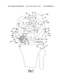 KNEE SIZING AND BALANCING INSTRUMENT diagram and image