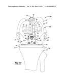 KNEE SIZING AND BALANCING INSTRUMENT diagram and image