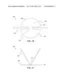 REMOVABLE DEPLOYMENT DEVICE, SYSTEM, AND METHOD FOR IMPLANTABLE PROSTHESES diagram and image