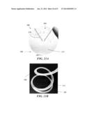 REMOVABLE DEPLOYMENT DEVICE, SYSTEM, AND METHOD FOR IMPLANTABLE PROSTHESES diagram and image