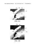 REMOVABLE DEPLOYMENT DEVICE, SYSTEM, AND METHOD FOR IMPLANTABLE PROSTHESES diagram and image