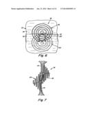 DOUBLE SPIRAL PATENT FORAMEN OVALE CLOSURE CLAMP diagram and image