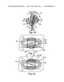 DOUBLE SPIRAL PATENT FORAMEN OVALE CLOSURE CLAMP diagram and image