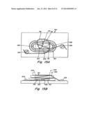 DOUBLE SPIRAL PATENT FORAMEN OVALE CLOSURE CLAMP diagram and image