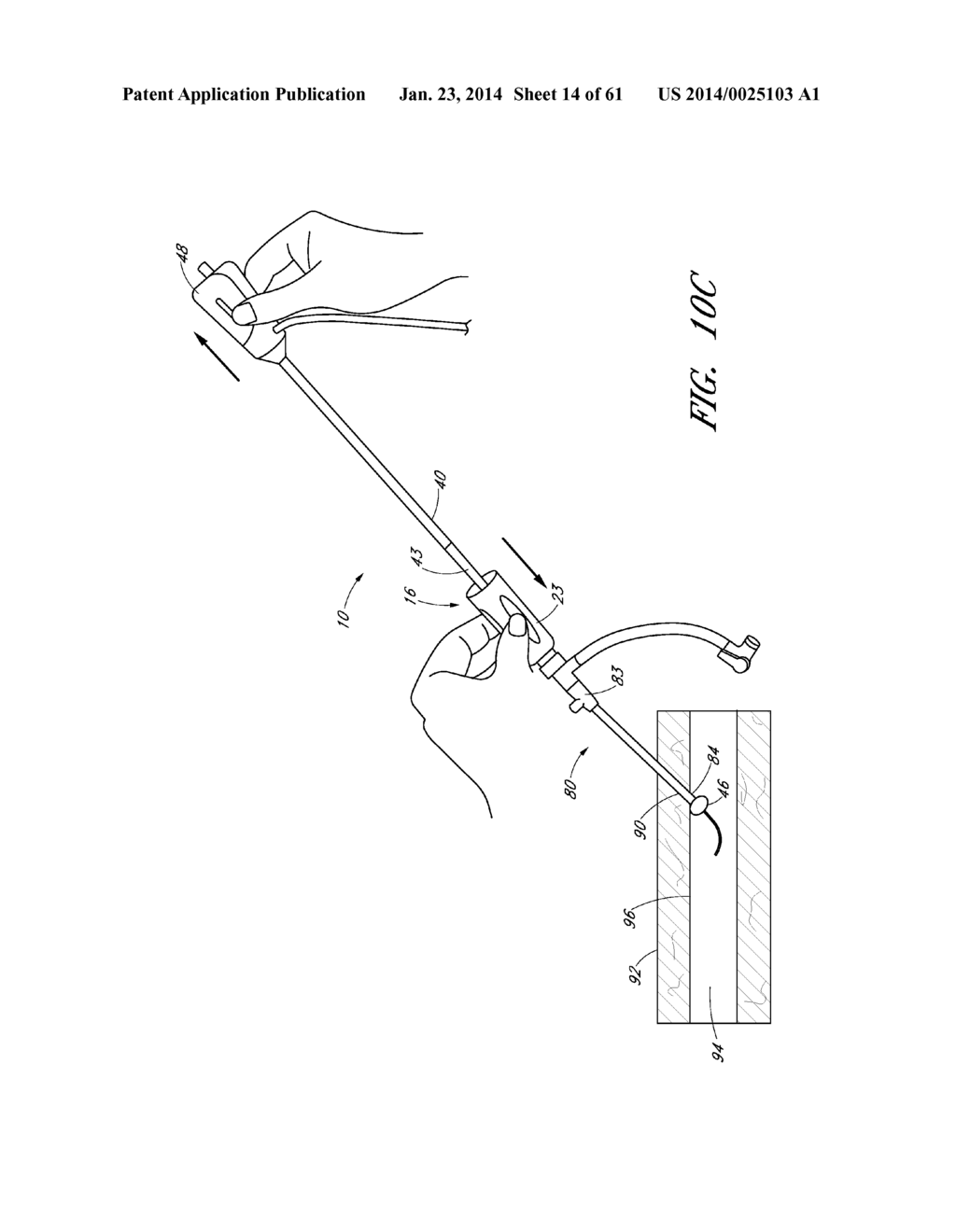 APPARATUS AND METHODS FOR SEALING A VASCULAR PUNCTURE - diagram, schematic, and image 15