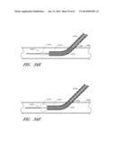 APPARATUS AND METHODS FOR SEALING A VASCULAR PUNCTURE diagram and image